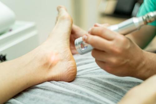 Ask Yourself These 3 Questions to See If Laser Therapy Might Help Stop Your Foot Pain